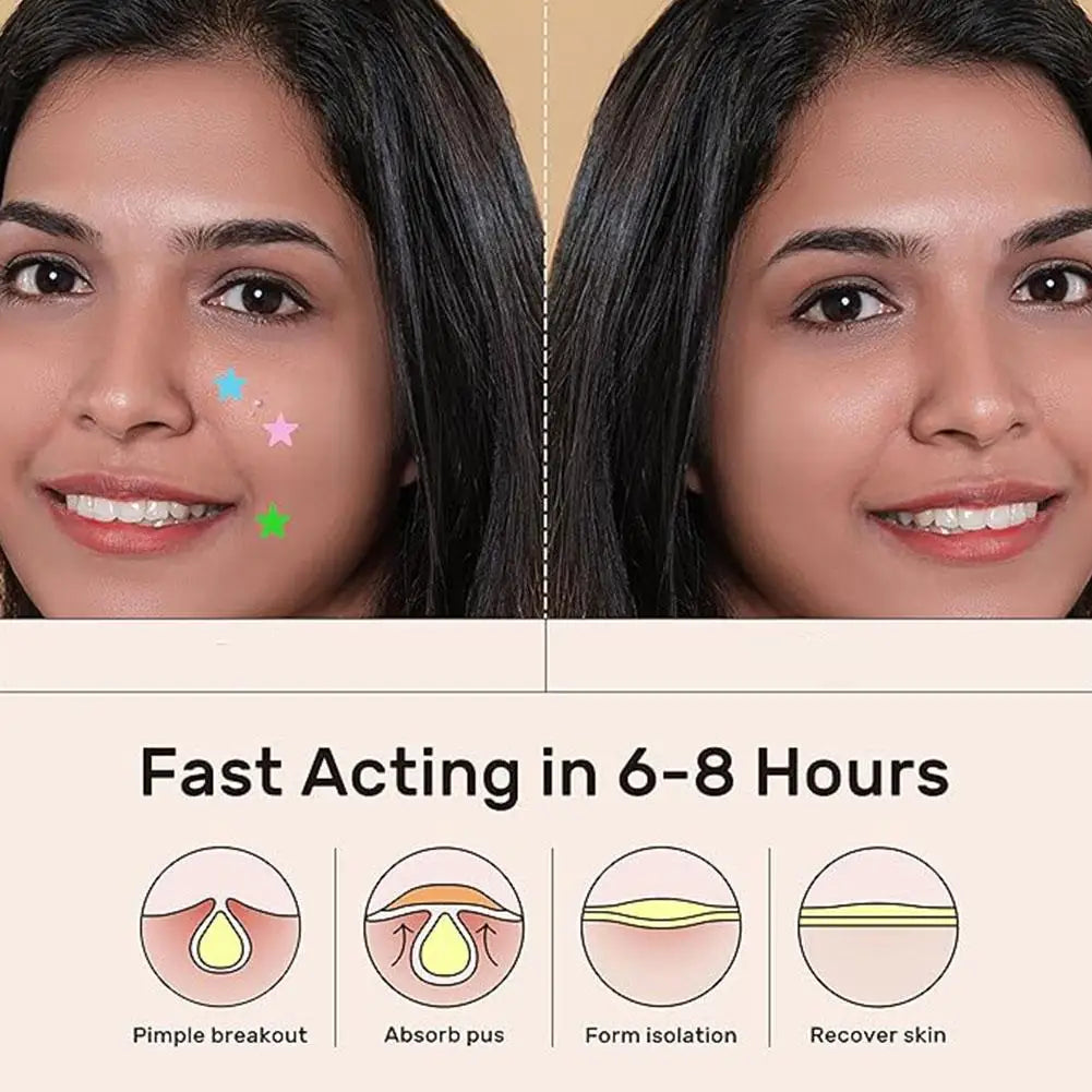 Colorful Star Pimple Patch – Invisible Acne Spot Stickers