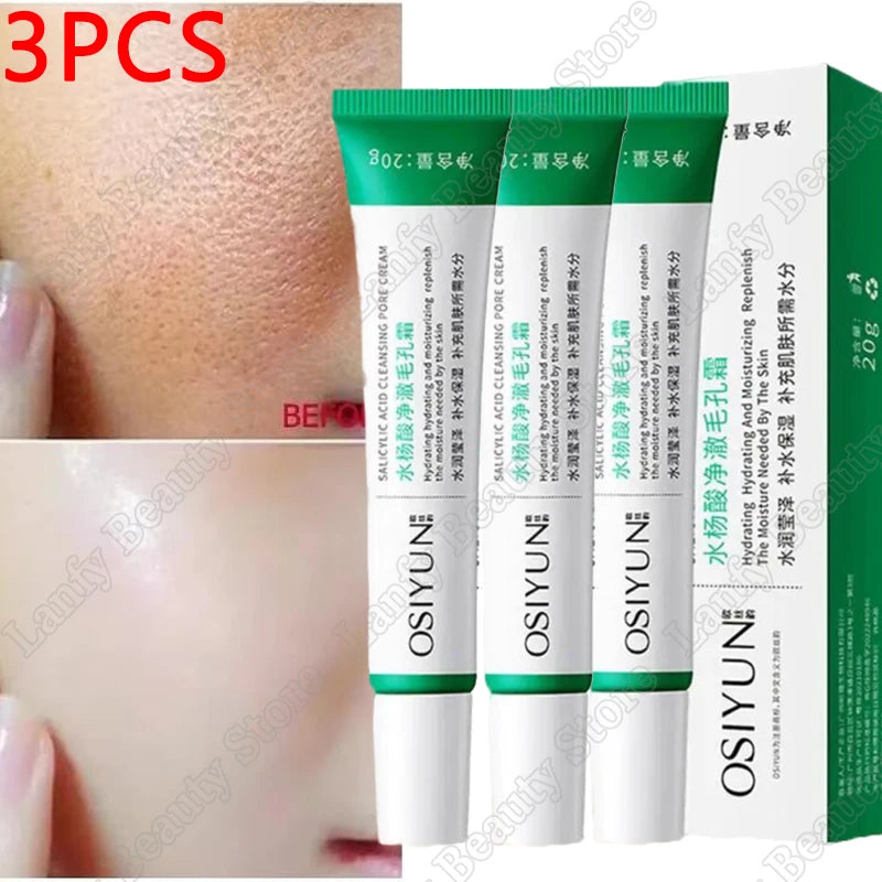 Salicylic Acid Pore Clearing Cream – Acne & Blackhead Treatment