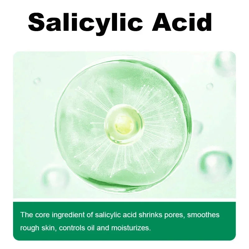 Salicylic Acid Pore Clearing Cream – Acne & Blackhead Treatment