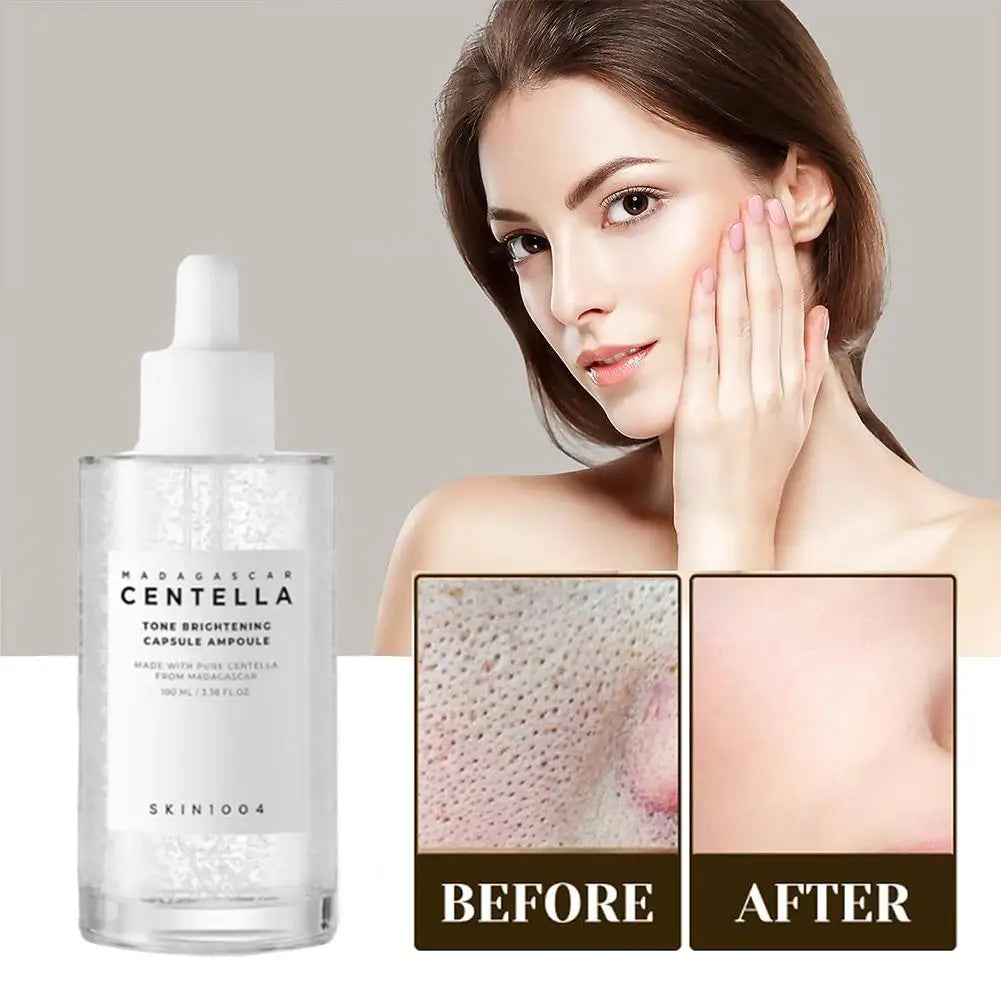 Skin1004 Centella Asiatica Ampoule – Hydrating & Brightening Serum