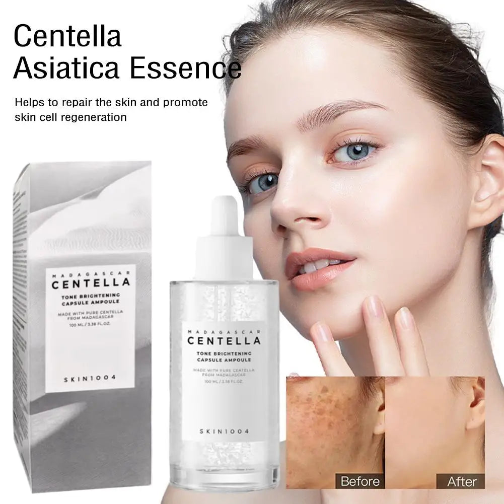 Skin1004 Centella Asiatica Ampoule – Hydrating & Brightening Serum