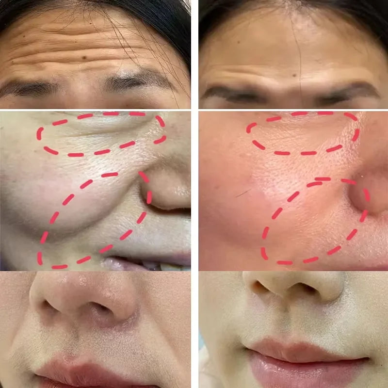 Collagen Wrinkle Removal Balm – Instant Anti-Aging & Firming