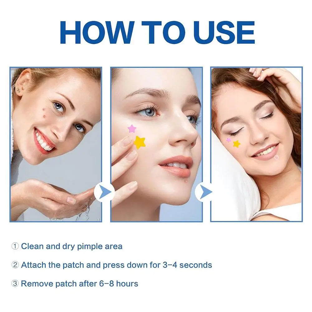 Colorful Star Pimple Patch – Invisible Acne Spot Stickers