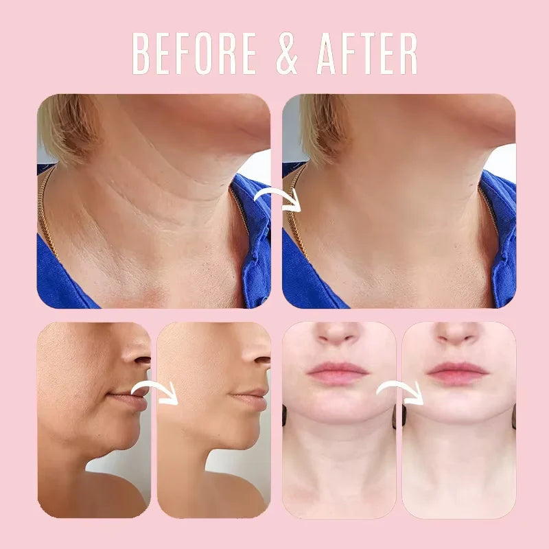 Collagen Wrinkle Removal Balm – Instant Anti-Aging & Firming