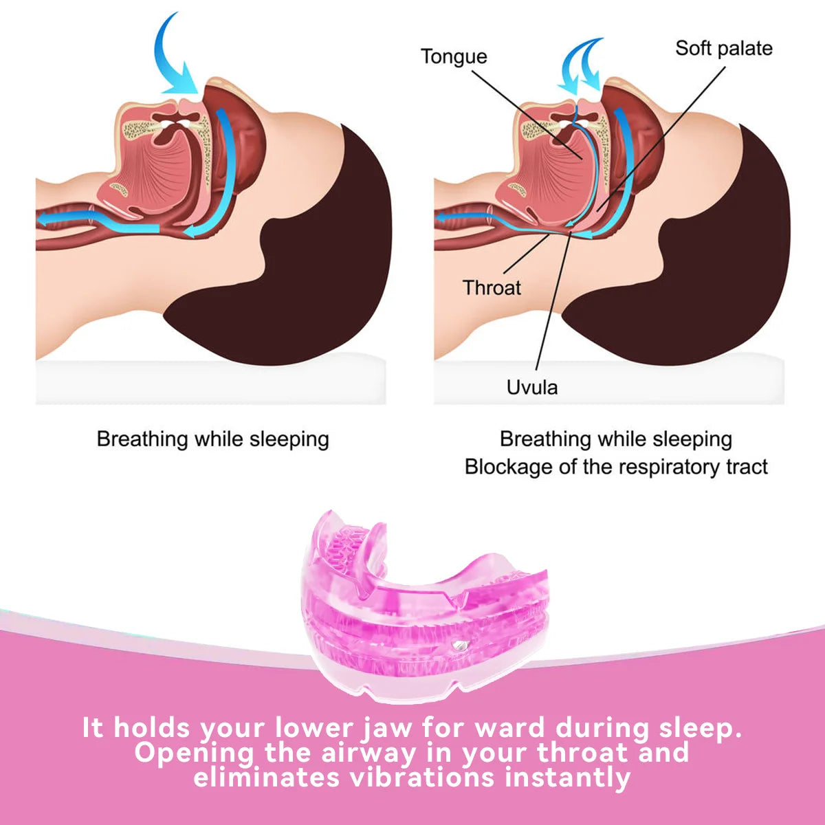 Adjustable Anti-Snoring Mouth Guard – Stop Snoring & Improve Sleep