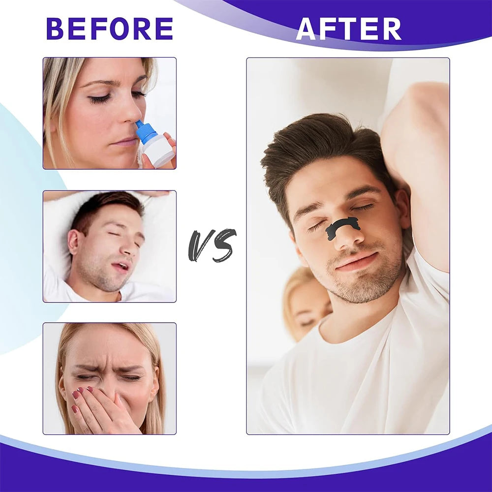 Black Nose Strips – Extra Strength Anti-Snoring Nasal Strips