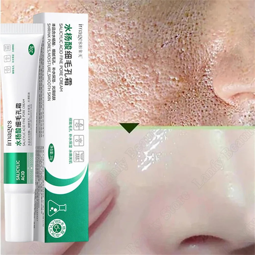 Salicylic Acid Pore Clearing Cream – Acne & Blackhead Treatment