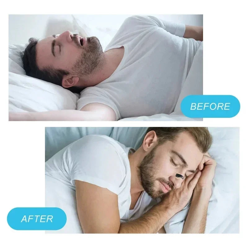 Anti-Snoring Nose Clip – Magnetic Nasal Breathing Dilator Kit