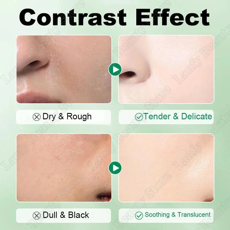 Salicylic Acid Pore Clearing Cream – Acne & Blackhead Treatment