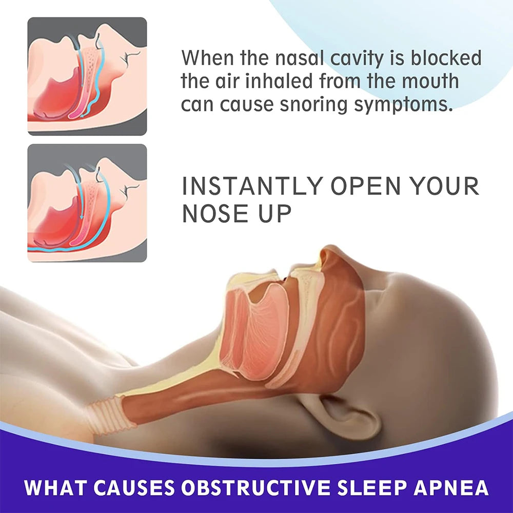 Black Nose Strips – Extra Strength Anti-Snoring Nasal Strips