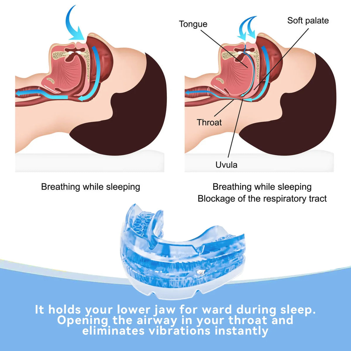 Adjustable Anti-Snoring Mouth Guard – Stop Snoring & Improve Sleep