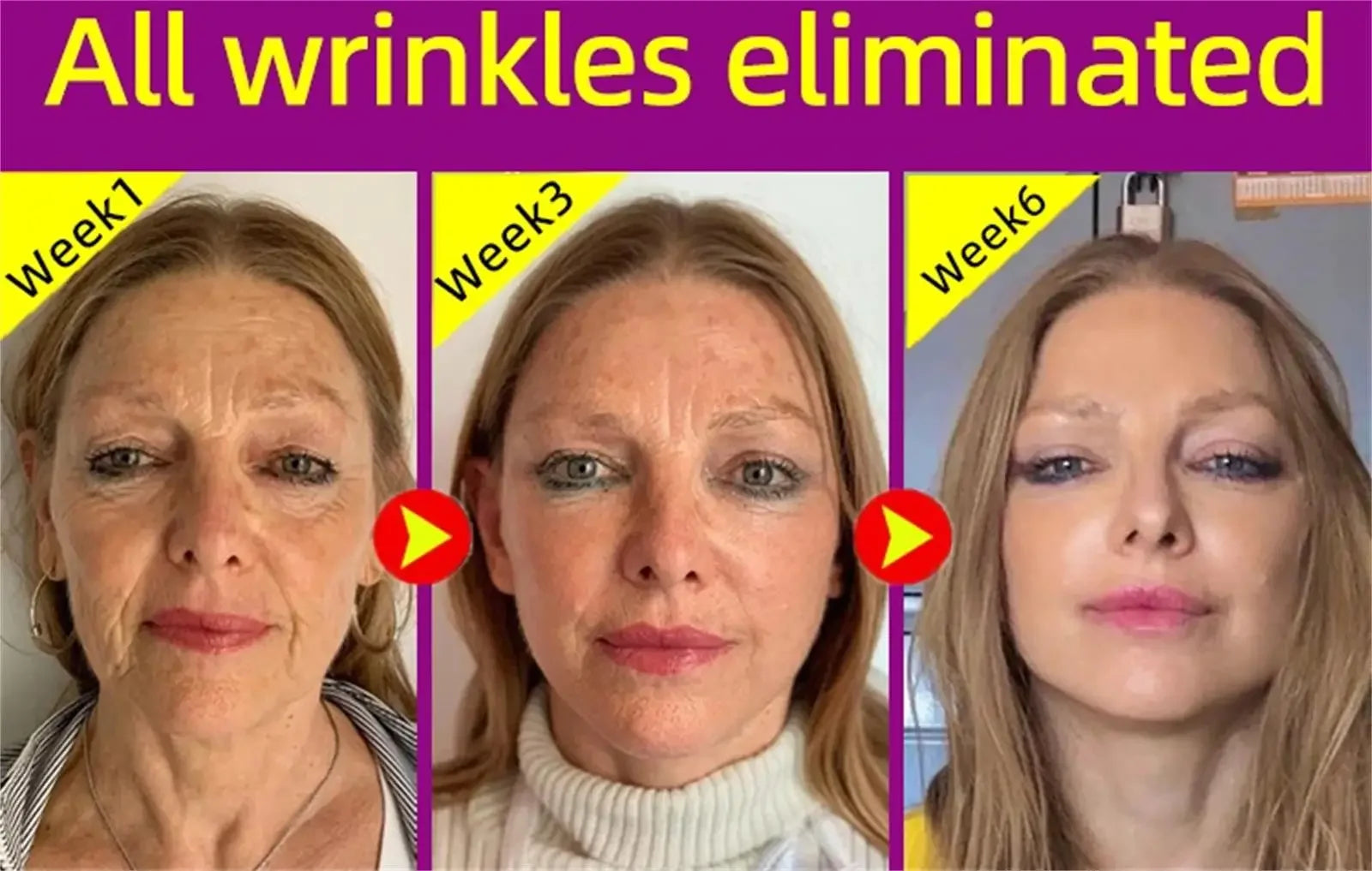Collagen Wrinkle Removal Balm – Instant Anti-Aging & Firming
