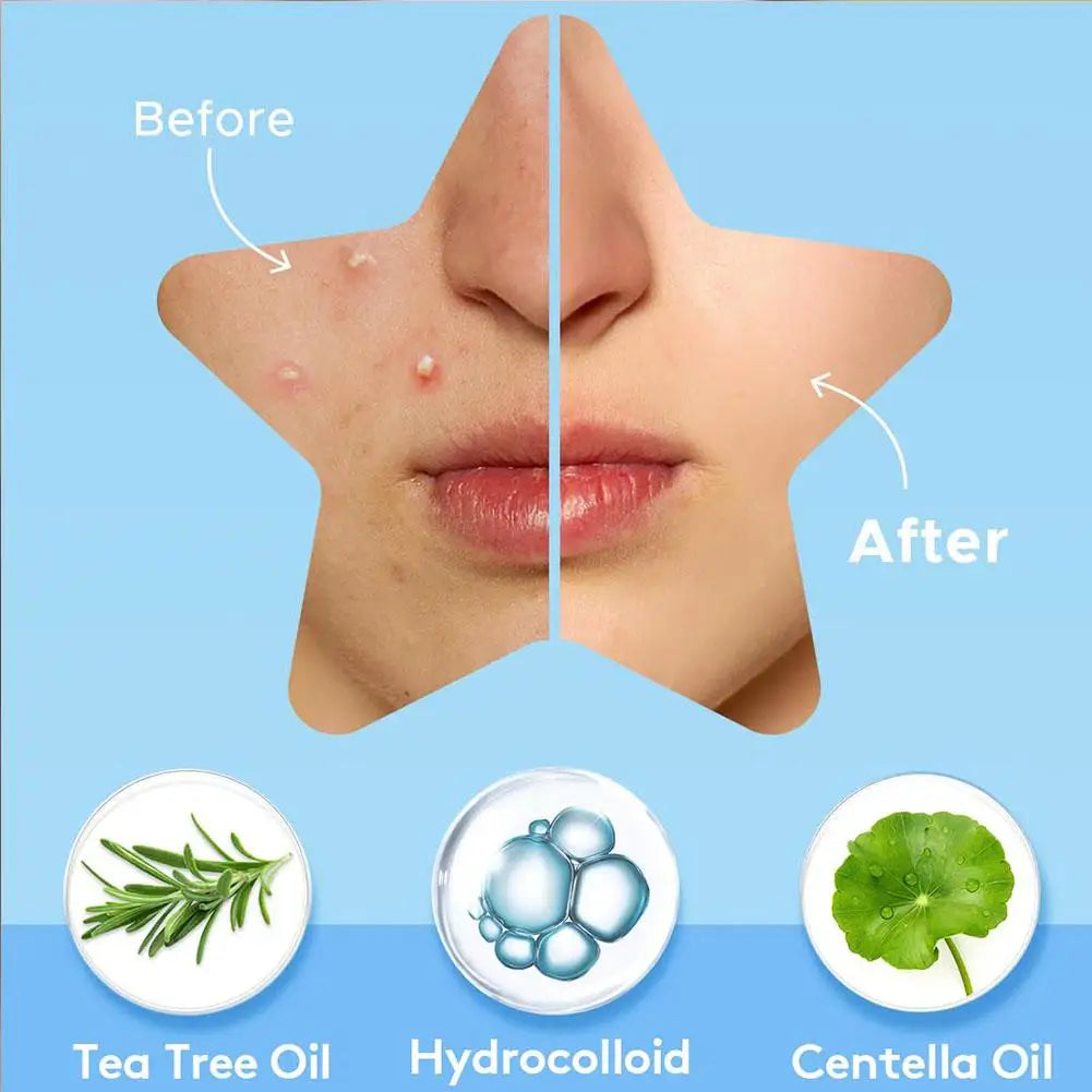Colorful Star Pimple Patch – Invisible Acne Spot Stickers