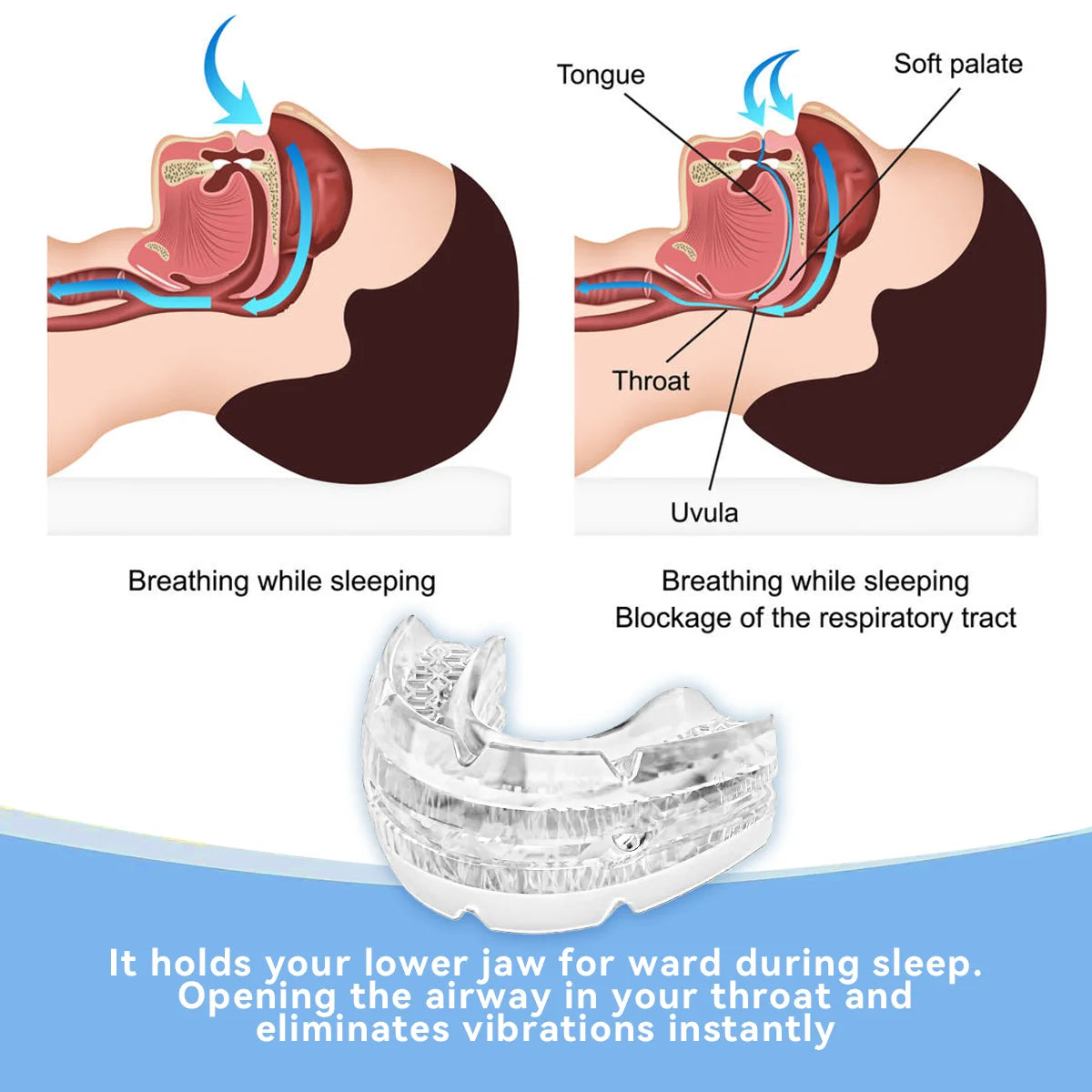 Adjustable Anti-Snoring Mouth Guard – Stop Snoring & Improve Sleep